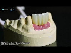 สกรูเก็บทิตาเนียม Custom Abutment โปรเซลีนหลอมไปยัง Zirconia
