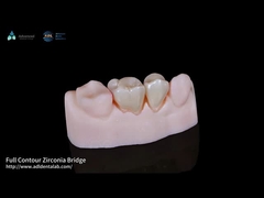 สีธรรมชาติ ครบวงจร Zirconia crown สีตรงครบวงจร Lab ฟัน