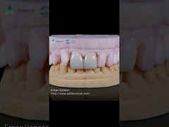 แผ่นฟีนเนอร์ EMAX ที่ถูกกดเป็นธรรมชาติ ความแข็งแรง 16 สี Emax ฟีนเนอร์ฟีนเนอร์ฟีนเนอร์ฟีนเนอร์ฟีนเนอร์ฟีนเนอร์ฟีนเนอร์ฟีนเนอร์ฟีนเนอร์