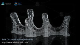 ยามกลางคืนที่พิมพ์ 3D แบบกำหนดเองเพื่อการบรรเทาอาการนอนกรนของฟัน