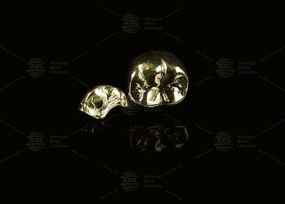 ซื้อ ทองเหลืองเหลืองสกัดมูลค่า 60% ทองคําครบครัน การผลิตออนไลน์