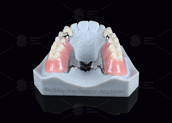 ซื้อ กุญแจเงินและการติดตั้ง Keyway การบํารุงรักษาง่าย การผลิตออนไลน์