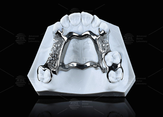 ซื้อ กรอบไทเทเนียมที่พิมพ์ 3D ความแข็งแกร่งสูงที่มีคลาสที่ชัดเจนสําหรับผลงานที่ยั่งยืน การผลิตออนไลน์