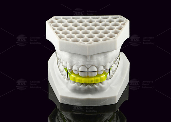 ซื้อ อุปกรณ์ Bionator Orthodontic Acrylic แก้ไขอาการคลาส II การผลิตออนไลน์