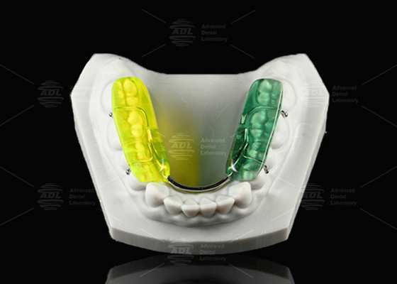 ซื้อ สีสัน Gelb ฟันสปริ้นต์ แข็งแรง Acrylic สาระ Occlusal สปริ้นท์สําหรับการบดฟันในเวลากลางคืน การผลิตออนไลน์