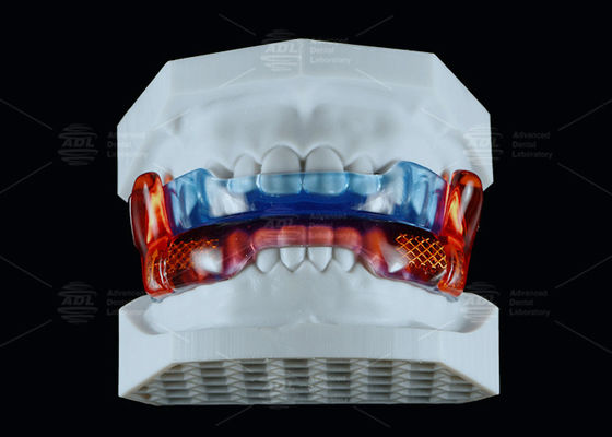 ซื้อ อุปกรณ์ป้องกันการหงุดหงิด สีซิลิโคนระดับการแพทย์ RP เพื่อช่วยให้นอนหลับได้ดีขึ้น การผลิตออนไลน์