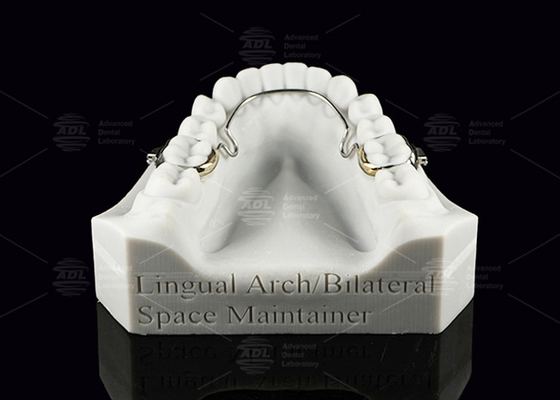 ซื้อ Lingual Arch Bilateral Space Maintainer ฟันเหล็กไร้ขุ่น ฟันขวาง การผลิตออนไลน์