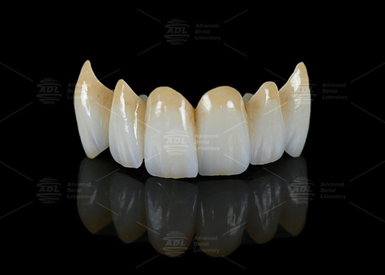 ซื้อ ความโปร่งใสสูง รูปทรงเต็ม Zirconia Bridge ความต้านทานต่อการฉีก การผลิตออนไลน์