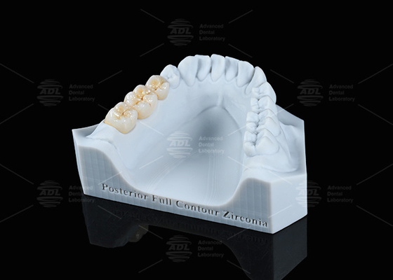 ซื้อ ใส ขาว ครบวงจร Zirconia Crown FCZ โมโนลิติก Zirconia Crown การบดง่าย การผลิตออนไลน์