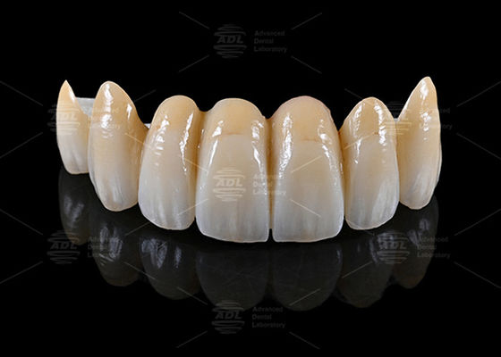 ซื้อ ห้องปฏิบัติการทันตแพทย์จีน จําหน่ายวัสดุ AIDITE ZIRCONIA BLOCK พร้อมเวลาในการทํางานใน 72 ชั่วโมงสําหรับการผลิตทันตแพทย์ การผลิตออนไลน์