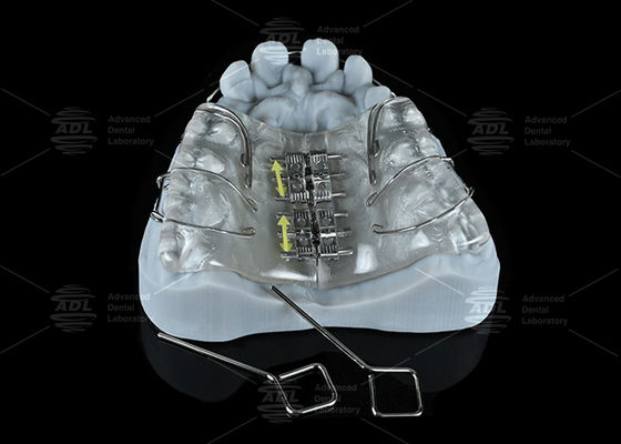 ซื้อ China Dental Lab สีสแตนเลสสกรูขยายสําหรับขยายคันและคัน การผลิตออนไลน์