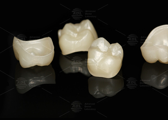 สีธรรมชาติ ครบวงจร Zirconia crown สีตรงครบวงจร Lab ฟัน