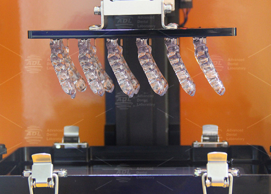 3D Printed Soft Occlusal Splints For Bruxism ความสบายใจ การพิมพ์ฟัน