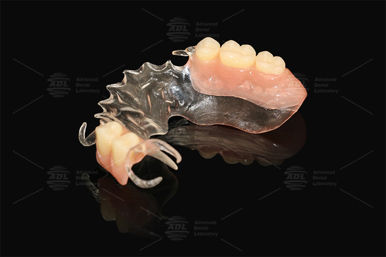 Vertex Clear Flexible Partial Virtually Unbreakable ความเสี่ยงของโรคภูมิแพ้ที่ต่ํา