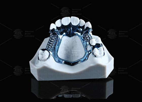 โอนอดิซ 3D Printed Titanium Frame น้ําหนักเบาและเหมาะสําหรับผิวที่อ่อนไหว