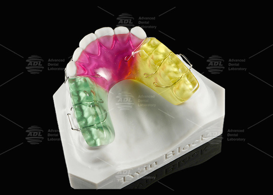 อุปกรณ์ Orthodontic Acrylic Twin Block สําหรับการแก้ไขอาการคล้อง