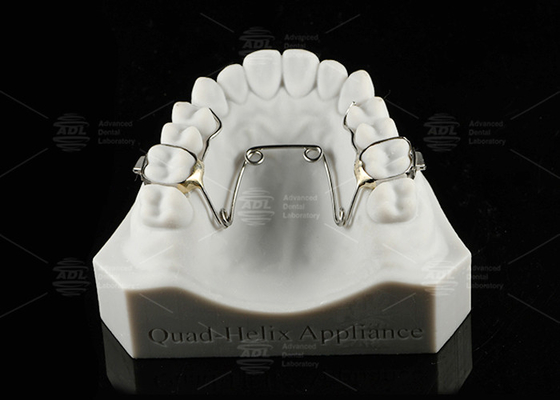 เด็กและวัยรุ่น อุปกรณ์ Quad Helix อุปกรณ์ Orthodontics สแตนเลส