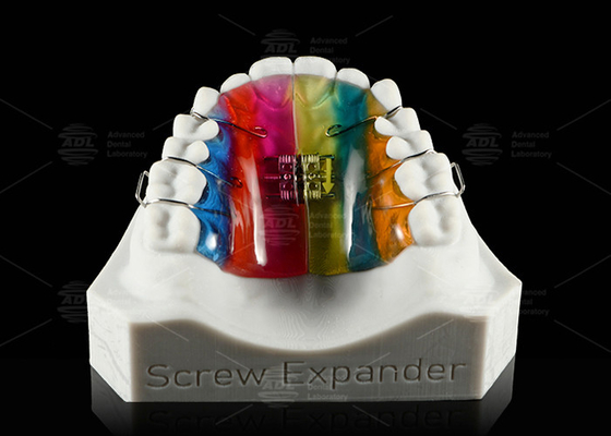 การขยายฟันและการขยายปาก การขยายฟัน Orthodontic