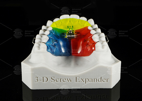 สแตนเลส สกรูอะคริลิค ขยายการรักษา Orthodontic ถอนได้