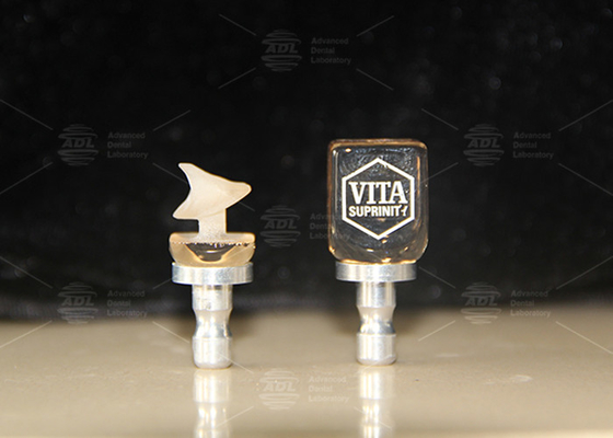 การฟื้นฟูฟันฟันเดียวแบบเซรามิกไฮบริด Vita Enamic ด้วยความโปร่งใสสูง