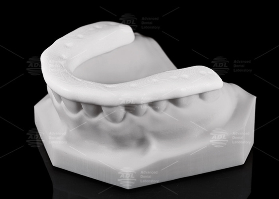 ความทนทานและความสามารถในการหายใจ 3D พิมพ์ไนลอน Occlusal Splint / Night Guard สําหรับรูปแบบชีวิตที่ทํางาน