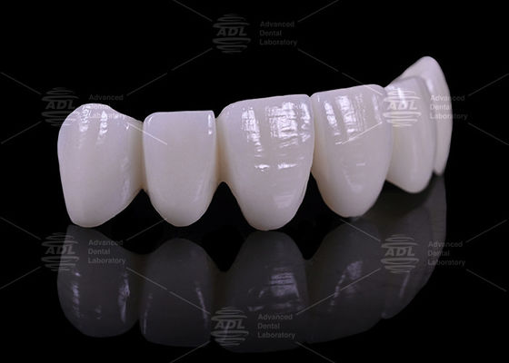 ราคาที่แข่งขันได้กับส่วนลดจํานวน ห้องปฏิบัติการฟันที่ให้บริการ 16 สี โปรเทสต์ฟันที่ปรับปรุงให้กับอุตสาหกรรมการแพทย์