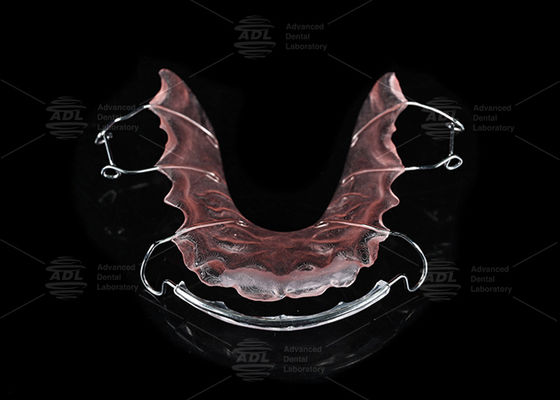จีนห้องปฏิบัติการฟัน สแตนเลสและอะคริลิค Orthodontic Hawley Retainer สําหรับการรักษา Orthodontic