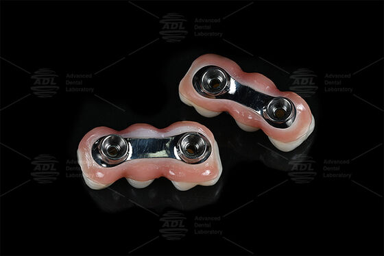 แรงเสริมอัมพานท์บาร์ CAD CAM ออกแบบให้เหมาะสมอย่างแม่นยํา เหมาะสมกับระบบอัมพานต์ฟันส่วนใหญ่ รับประกันการแก้ไขการฟันฟันฟัน Chinese Dental Lab