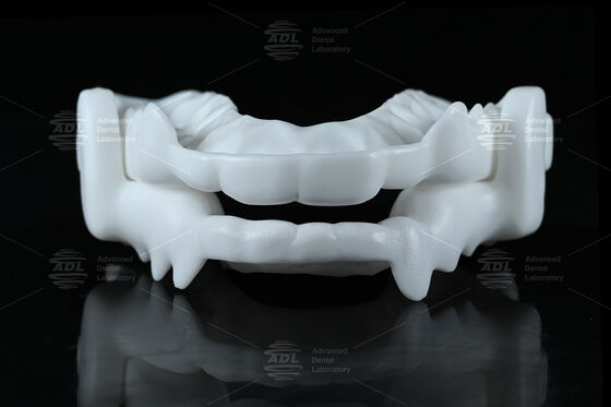 เฝือกสบฟันเกรดทางการแพทย์ไนลอนพร้อมดีไซน์ CAD/CAM ยืดหยุ่นเพื่อป้องกันภาวะนอนกัดฟัน